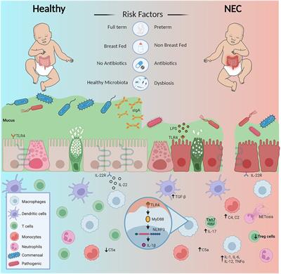 Frontiers | Necrotizing enterocolitis: Bench to bedside approaches